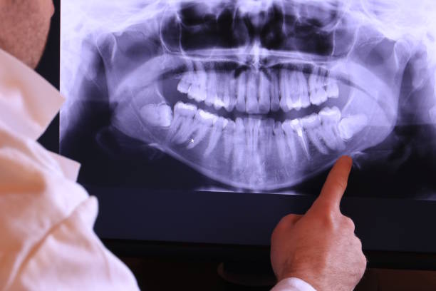 Best Weekend Emergency Dental Services in New Ellenton, SC